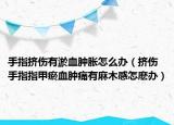 手指挤伤有淤血肿胀怎么办（挤伤手指指甲瘀血肿痛有麻木感怎麽办）