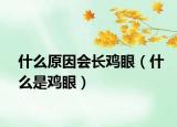 什么原因会长鸡眼（什么是鸡眼）