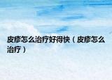 皮疹怎么治疗好得快（皮疹怎么治疗）
