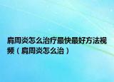 肩周炎怎么治疗最快最好方法视频（肩周炎怎么治）