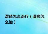 湿疹怎么治疗（湿疹怎么治）