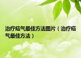 治疗疝气最佳方法图片（治疗疝气最佳方法）
