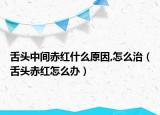 舌头中间赤红什么原因,怎么治（舌头赤红怎么办）