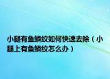 小腿有鱼鳞纹如何快速去除（小腿上有鱼鳞纹怎么办）