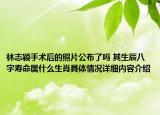 林志颖手术后的照片公布了吗 其生辰八字寿命属什么生肖具体情况详细内容介绍