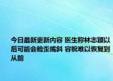 今日最新更新内容 医生称林志颖以后可能会脸歪嘴斜 容貌难以恢复到从前