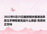 2022年8月25日最新相关报道消息 碧玉手镯有聚黑是什么原因 有黑块正常吗