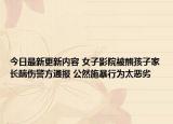今日最新更新内容 女子影院被熊孩子家长踹伤警方通报 公然施暴行为太恶劣