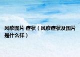 风疹图片 症状（风疹症状及图片是什么样）