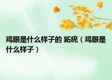 鸡眼是什么样子的 跖疣（鸡眼是什么样子）