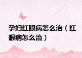 孕妇红眼病怎么治（红眼病怎么治）