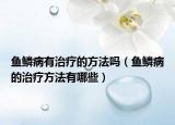 鱼鳞病有治疗的方法吗（鱼鳞病的治疗方法有哪些）