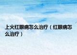上火红眼病怎么治疗（红眼病怎么治疗）