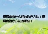 银屑病有什么好的治疗方法（银屑病治疗方法有哪些）