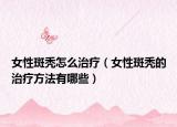 女性斑秃怎么治疗（女性斑秃的治疗方法有哪些）