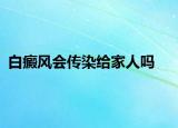白癜风会传染给家人吗