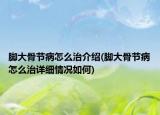 脚大骨节病怎么治介绍(脚大骨节病怎么治详细情况如何)