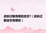 皮肤过敏有哪些症状?（皮肤过敏症状有哪些）