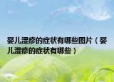 婴儿湿疹的症状有哪些图片（婴儿湿疹的症状有哪些）