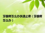 牙龈疼怎么办快速止疼（牙龈疼怎么办）