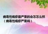 病毒性疱疹最严重的会怎怎么样（病毒性疱疹严重吗）