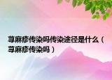 荨麻疹传染吗传染途径是什么（荨麻疹传染吗）