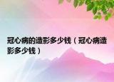 冠心病的造影多少钱（冠心病造影多少钱）