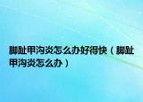 脚趾甲沟炎怎么办好得快（脚趾甲沟炎怎么办）