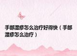 手部湿疹怎么治疗好得快（手部湿疹怎么治疗）