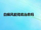 白癜风能彻底治愈吗