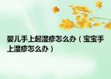 婴儿手上起湿疹怎么办（宝宝手上湿疹怎么办）