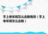 手上老年斑怎么去除有效（手上老年斑怎么去除）
