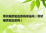 带状疱疹能自愈吗传染吗（带状疱疹能自愈吗）