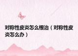 对称性皮炎怎么根治（对称性皮炎怎么办）