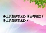 手上长湿疹怎么办 原因有哪些（手上长湿疹怎么办）
