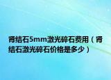 肾结石5mm激光碎石费用（肾结石激光碎石价格是多少）