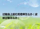 过敏身上起红疙瘩痒怎么办（皮肤过敏怎么办）