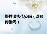 慢性湿疹传染吗（湿疹传染吗）