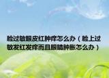 脸过敏眼皮红肿痒怎么办（脸上过敏发红发痒而且眼睛肿胀怎么办）
