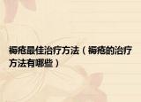 褥疮最佳治疗方法（褥疮的治疗方法有哪些）