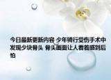 今日最新更新内容 少年骑行受伤手术中发现少块骨头 骨头画面让人看着感到后怕