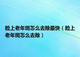 脸上老年斑怎么去除最快（脸上老年斑怎么去除）