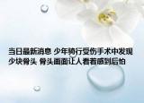 当日最新消息 少年骑行受伤手术中发现少块骨头 骨头画面让人看着感到后怕