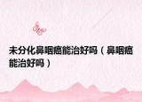 未分化鼻咽癌能治好吗（鼻咽癌能治好吗）
