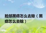 脸部黑痣怎么去除（黑痣怎么去除）