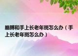 胳膊和手上长老年斑怎么办（手上长老年斑怎么办）