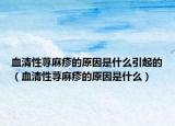 血清性荨麻疹的原因是什么引起的（血清性荨麻疹的原因是什么）