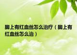 脚上有红血丝怎么治疗（脚上有红血丝怎么治）