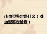 rh血型鉴定是什么（Rh血型鉴定检查）