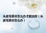 头皮毛囊炎怎么办才能治好（头皮毛囊炎怎么办）